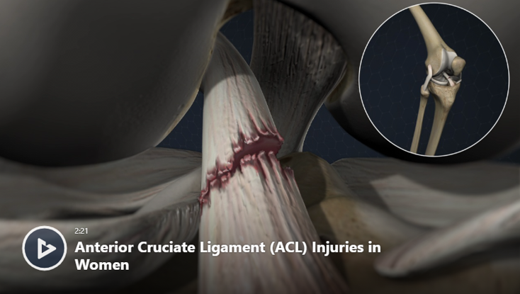 Rehabilitation Of Primary And Revision Anterior Cruci Vrogue Co