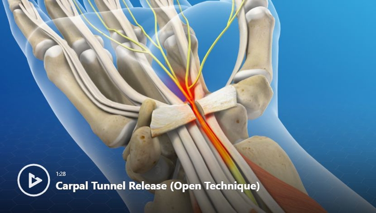 Hand & Wrist Conditions & Treatments | Newport Orthopedic Institute