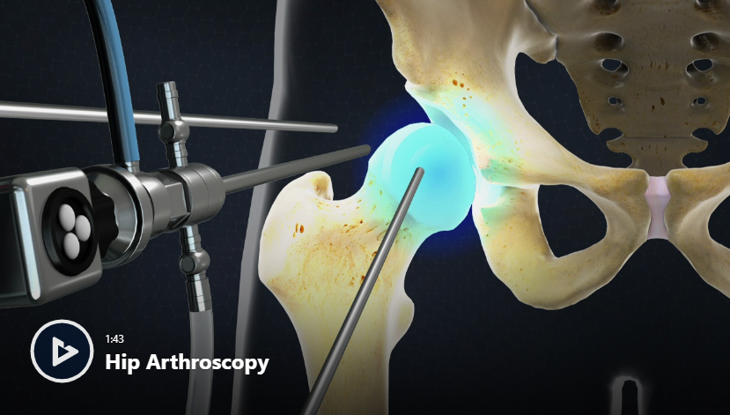 Hip Conditions & Treatments | Orthopedists Newport Beach, CA