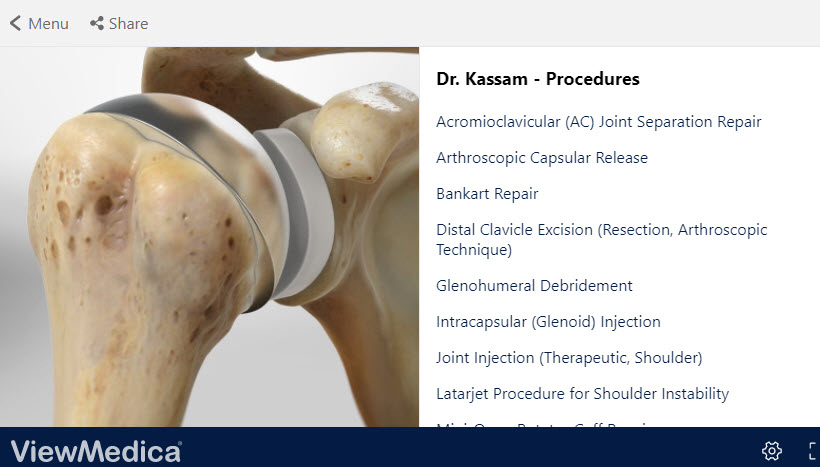Dr. Kassam - Shoulder Procedure Video